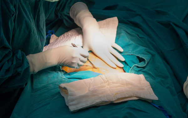 Best Laparoscopic Doctor Jaipur